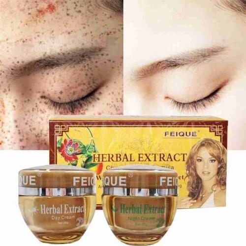 Powerful Whitening Freckle Cream Chinese Herbal Plant Whitening Remove Skin Dark 40g Freckles Face Spots Cream Cream And J5I6