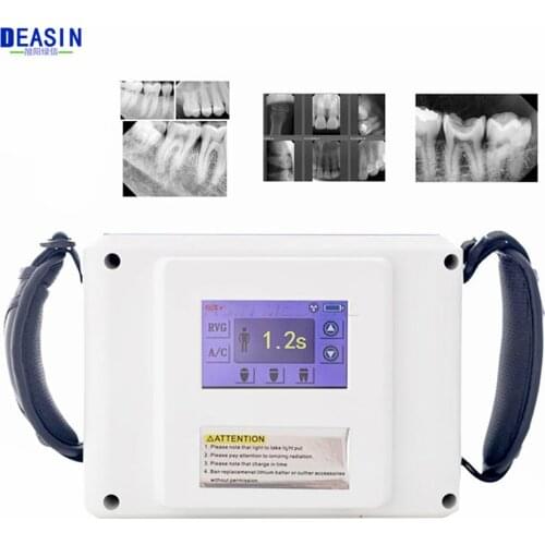 Dental Portable X Ray Unit/High Frequency Dental X-Ray Machine/Dental Imaging System With Touch Screen Other Dental Equipment