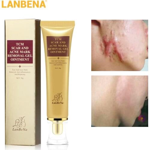 LANBENA Acne Scar Stretch Marks Remover Cream Skin Repair Face Cream Blackhead Whitening Strentch Marks Ginseng Extract 65