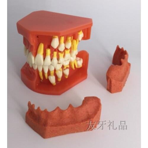 Childrens deciduous teeth replacement dental model oral cavity model permanent teeth alternate display
