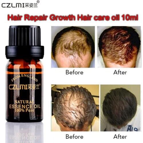 Okeny's Hair Growth Masks