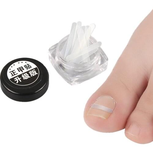 10pcs/box Toe Nail Ingrown Correction Sticker Patch Foot Care Paronychia Correction File Elastic Patch Corrector Treatment Tools