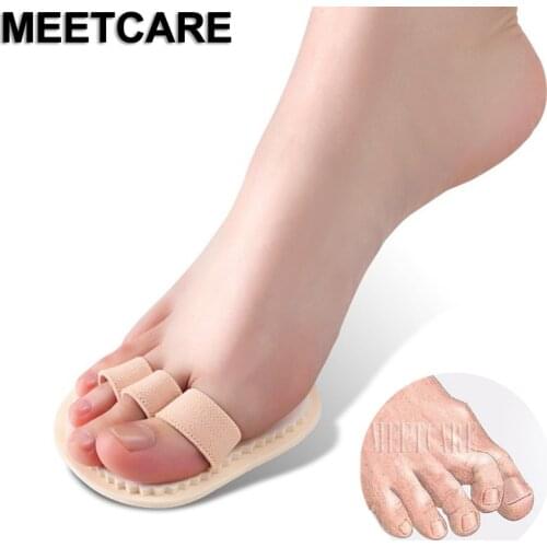 1 Pair Toes Overlap Hammer Toe Correction Pad Soft Bunion Splint Corrector Forefoot Mat for Hallux Valgus Tacones Foot Care
