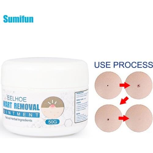 1pcs 50g Skin Tag Removal Ointment Warts Remover Antibacterial Cream Corn Callus Plaster Wart Treatment Herbal Skin Care P0202