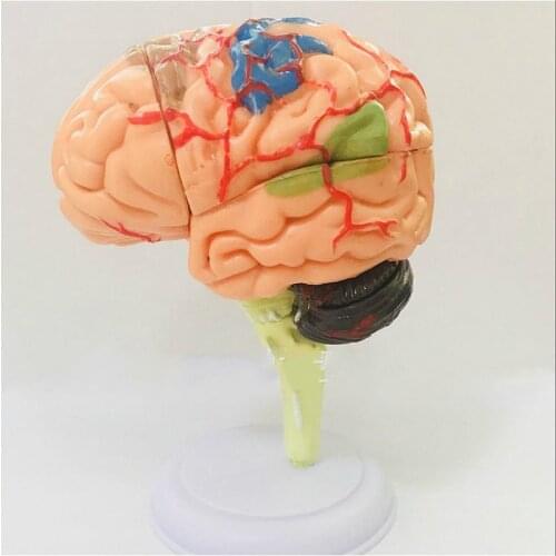 31 parts Puzzle assembly toy human organ assembly model brain model 4D brain assembly model teaching and application medicine