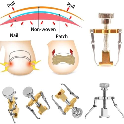 1 pcs Toe nail Correction For TreatmentIngrown Toenail Nail RecoverClamp Stainless Steel Paronychia Foot Lifter Care Tool