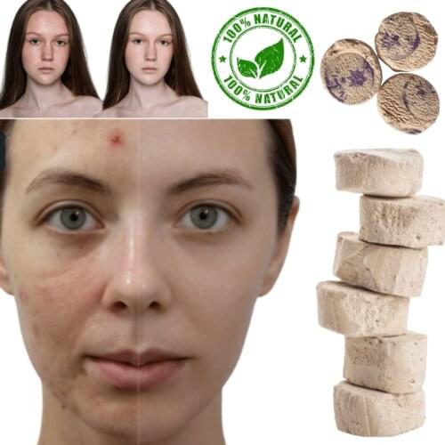 Sefidab Rooshoor Rusur peeling body care skin whitening stone cellulite meme psoriasis bleaching stone for dark skin health