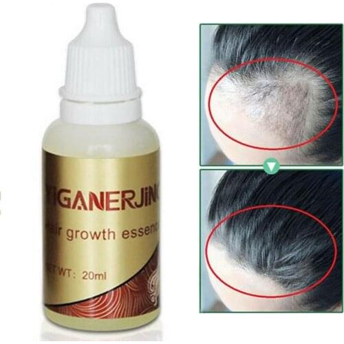20ml Hair Growth Liquid Hair Growth Serum Oil Natural Extract Hair Loss Treatment Hair Care Product TSLM1
