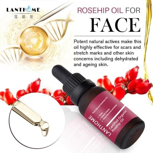 Pure Organic Rosehip Oil for Scars Fine Lines Wrinkle Stretch Marks Dehydrated Ageing Skin Whitening Moisturizer Anti-Aging 10ml