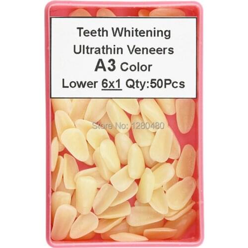 Veneers Densdal China