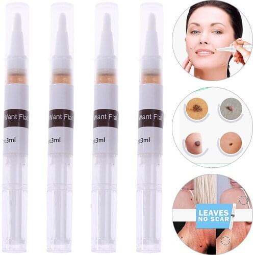 Genital Wart Treatment Papillomas Removal of Warts Liquid From Skin Tags Removing Against Moles Remover Wart Removal 3ML