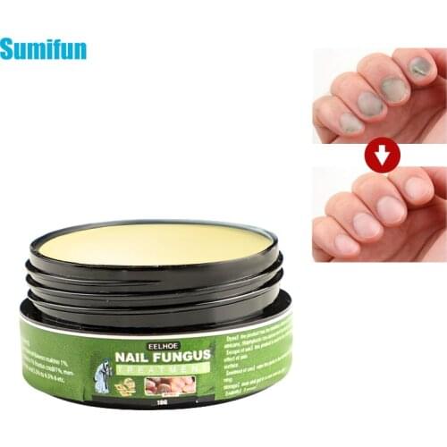 1Pcs 10g Fungal Nail Treatment Oil Paronychia Cream Antibacterial Repair Ointment Whitening Toe Anti Infection Nail Repair Cream