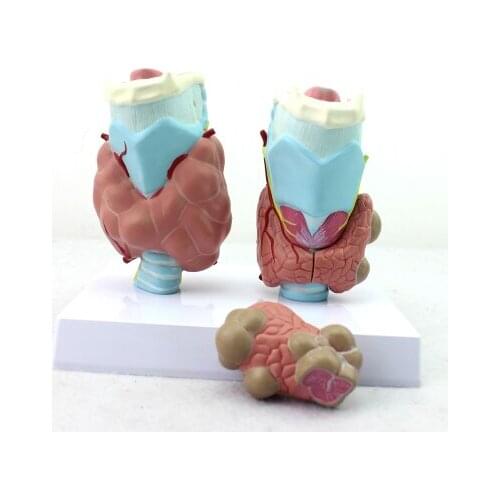 The thyroid gland The pathological model human Endocrine system anatomy model