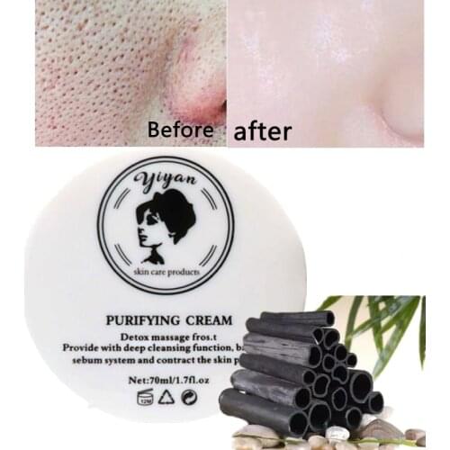 Purifying Cream Facial Skin Care Detox Care Whitening Deep Cleansing Remove Blackhead Dark Spot Acne Treatment Brightening