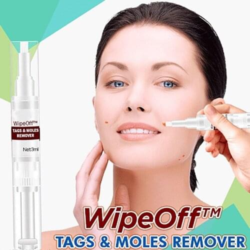 Genital Wart Treatment Papillomas Removal of Warts Liquid From Skin Tags Removing Against Moles Remover Wart Removal liuld