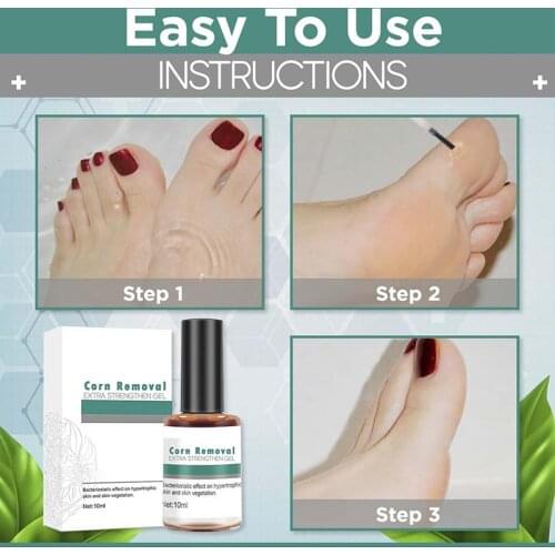 10ml Skin Tag Remover Liquid Warts Plaster Corns Treatment Antibacterial Liquid Relieve Pressure Little Moles Warts Skin Care