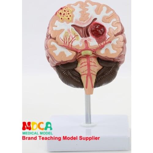 MDN008 Teaching of Brain Model Medicine for Senile Patients with Human Pathology, Brain, Cardiovascular and Cerebrovascular Dise