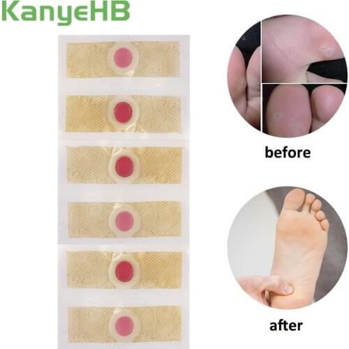24pcs Medical Detox Foot Pads Patches Feet Care Medical Plaster Foot Corn Removal Remover A174