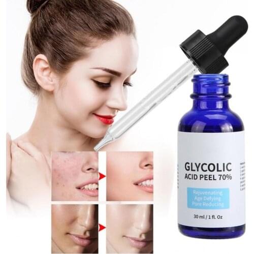 30ml Glycolic Acid Peel Repair Solution Shrink Pores And Oil Balance Improve Skin Nourishing Color Acne Light Water Skin U0L5