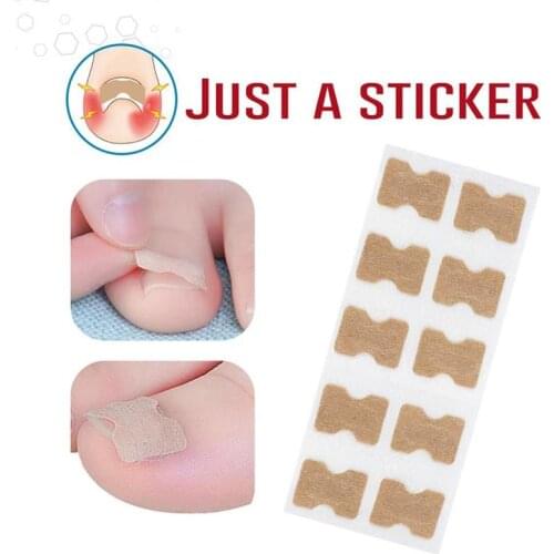 50 Pcs Ingrown Toenails Patch Sticker Toenail Patch Corrector Pedicure Tools Ingrown Toenail Correction Patch For Women Men