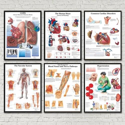 Pathology Chart Anatomy Diseases Posters And Prints Canvas Art Painting Wall Pictures For Living Room Decoration Home Decor