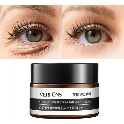 Instant Removal of Eye Bags Cream, Retinol cream, Anti-puffiness gel, Dark circles, Delays aging, Reduces wrinkles, Tightens