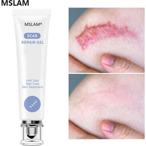 MSLAM Scar Removal Gel Removal Strectch Mark Scar Spot Cream Ance Treatment Pigmentation Corrector Whitening Skin Repair Care