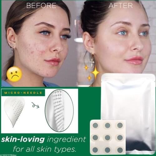 9 Patches Microneedle Acne Pimple Healing Patch Anti Acne Pimple Patch Soothing Face Skin Healing Zit Stickers Blemish Treatment