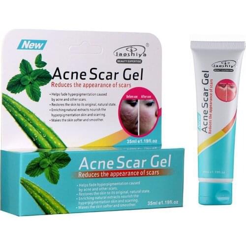 Aloe vera gel acne acne scars oil control moisturizing shrinking pores soothing face serum beauty products skin care products