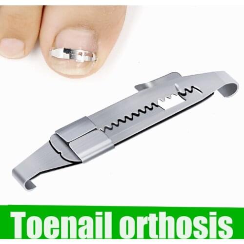 New Arrival Ingrown Toe Nail Correction Tool Toenail Straightening Correctors Patch Tool Ingrown Toe Nail Correction Tool-30