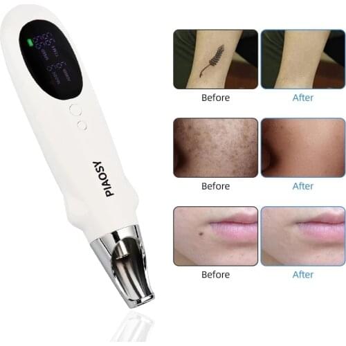 Newest Neatcell Handheld Picosecond Laser Tattoo Removal Profesional Machine 9+9 Upgrade Mole Tattoo Wart Remover Pen Fade Line