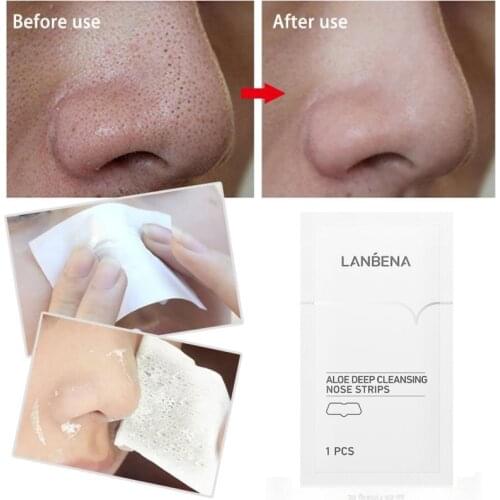 10pcs LANBENA Aloe Deep Cleansing Nose Strips Blackhead Removal Mask Eliminate Blackheads Clean Shrink Pores Skin Cleaning Care