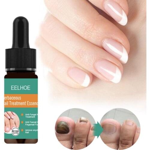 Nail Repair Treatments Liquid Essence Oil Fungus Removal Health Bactericidal Natural Nourishing Nail Care Tools 10/30ml Tslm2