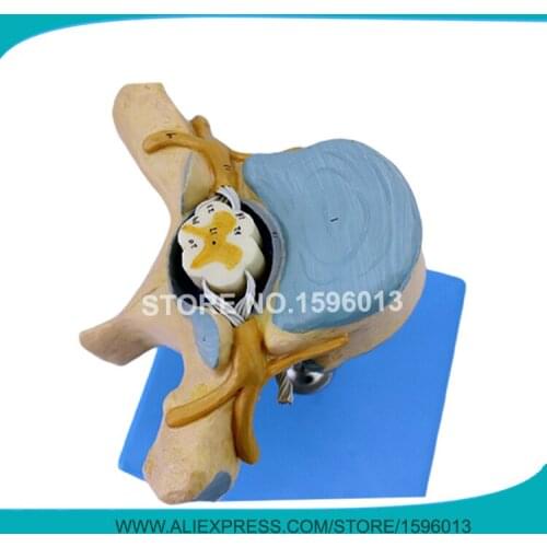 Anatomical Thoracic Vertebrae with Spinal Cord and Nerves model,Thoracic Spine Model