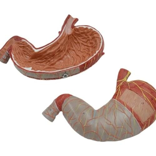 Enlarged 2 Parts Human Stomach Model Digestive System Anatomical body Anatomy Medical Supplies and Equipment