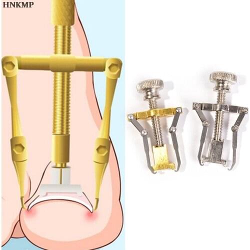 Stainless Steel Fixer Recover Toe Paronychia Nail Brace Tools Ingrown Toenails Pedicure Tool Ingrown Toe Nail Correction Tool