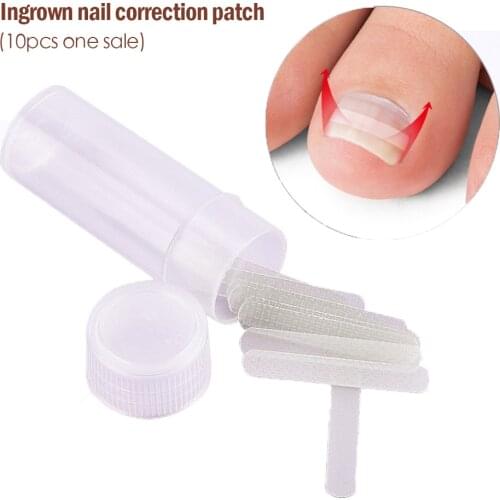 10pcs/pack Toenail Straightening Clip Ingrown Toenail Correction Tool Nail Treatment Elastic Patch Sticker Foot Care Pedicure