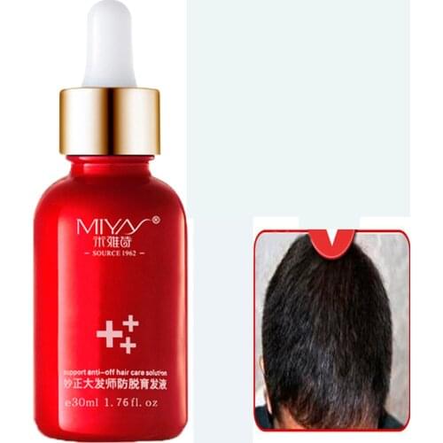 Hair Oil Hair Care Fast Powerful Hair Growth Products Regrowth Essence Liquid Treatment Preventing Hair Loss For Men And Women