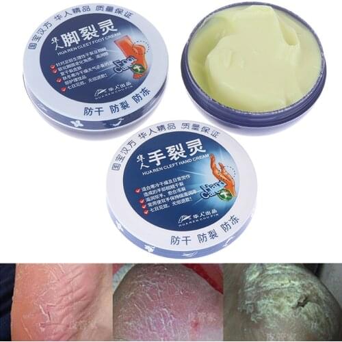 Feet and hand Care Repair Cream Removal Dead Skin Hand Traditional Chinese Oil Anti-Drying Crack Foot Cream Heel Cracked