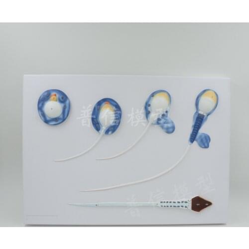 Free shipping&Sperm model, male reproductive model, family planning, medical, cellular model, testis, anatomy for medical school