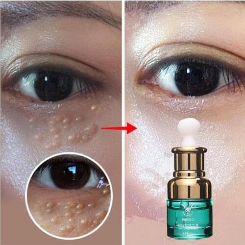 Hyaluronic Acid Eye Cream Lighten dark circles remove eye bags fat particles Eye Serum Anti skin care cream