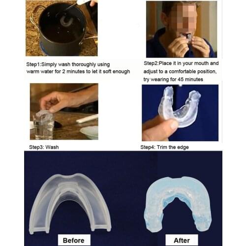 Stop Snoring Anti Snore Soft Silicone Mouthpiece Apnea Guard Bruxism Tray Night Sleeping Aid Health99