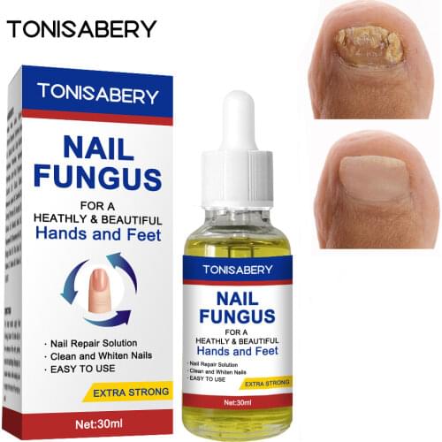 SAKSRAAR Nail Fungus Oils