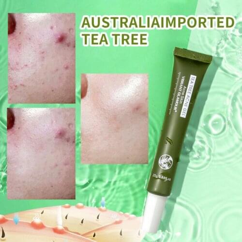Acne Treatment Face Cream Tea Tree Acne Gel Serum 25g Acne Balance Water Oil Fade Scar Spots Skin Care Face Acne Removing Gel