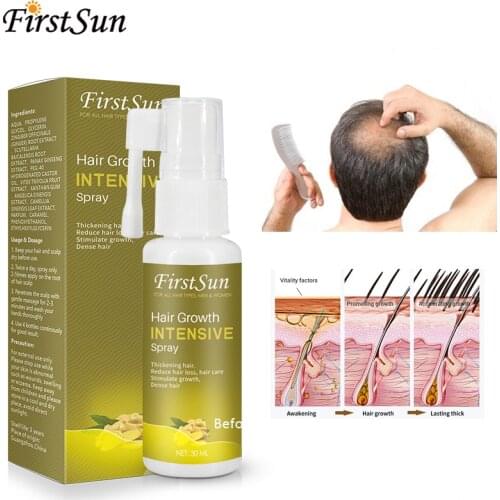 Firstsun Ginger Fast Hair Growth Spray Essential Oil Anti Preventing Hair Lose Serum Damaged Hair Repair Growing Women Men TSLM1