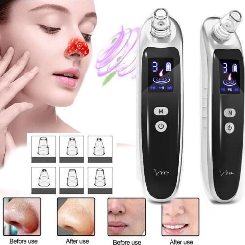 LED Electric Blackhead Removal Beauty Instrument Vacuum Suction Face Pores Cleaning Device Blackhead Cleaner Nose AcneFacialCare