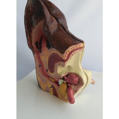 The dog ear model On the left is a healthy dogs ear model on the right is the pathological dogs ear model