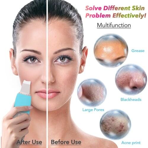 Ultrasonic Facial Skin Scrubber Electric Exfoliating Face Skin Cleaning Peeling Device Rechargeable Beauty Instruments SkinCare
