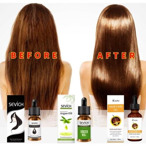 Sevich Care Hair Growth Essential Oils Essence Original Authentic 100% Anti Hair Loss Products Liquid Health Care Beauty Dense