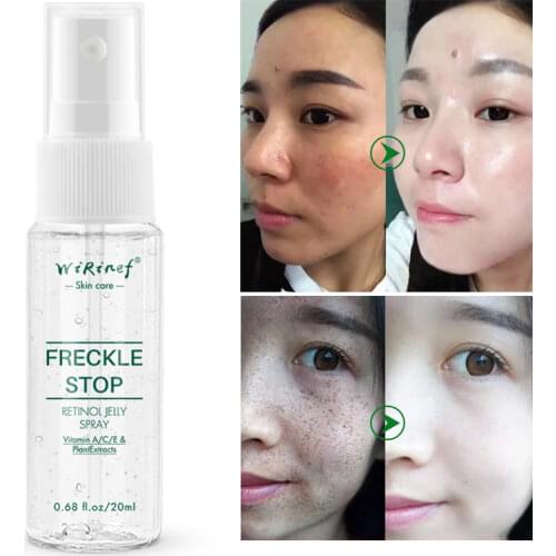 Freckle Inhibition Spray 20ml Face Care Whitening Jelly Spray Remove Freckle Melasma Acne Spots Pigment Sunburn Melanin